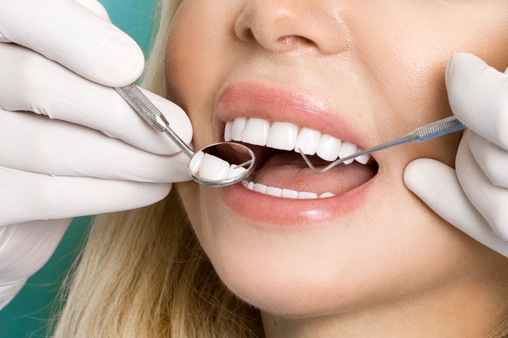 Teeth Whitening Solutions for you