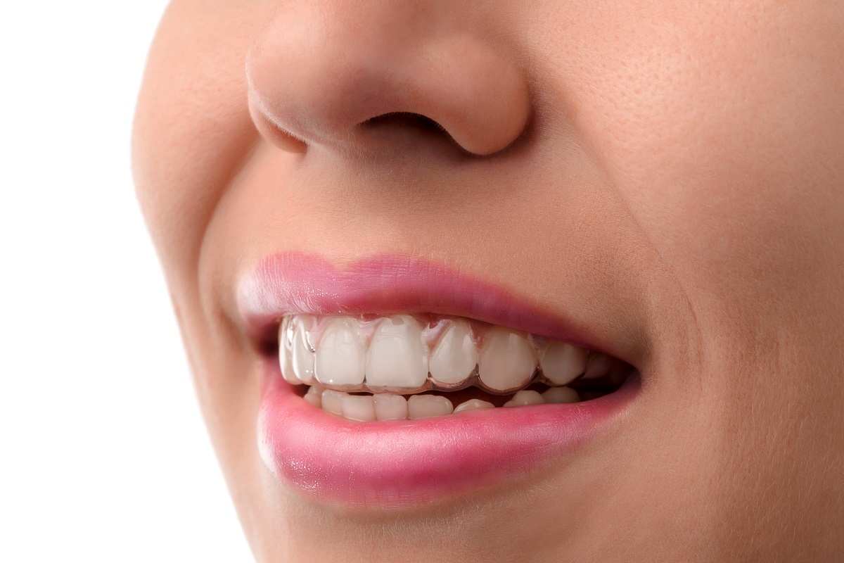 woman with invisible aligners smiling