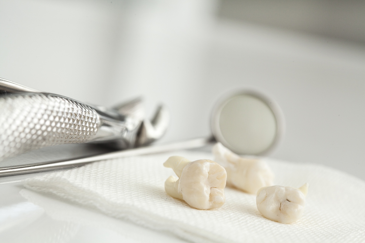 pulled teeth on a napkin