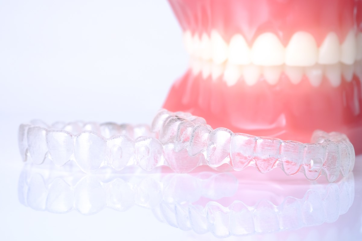 Aligners model