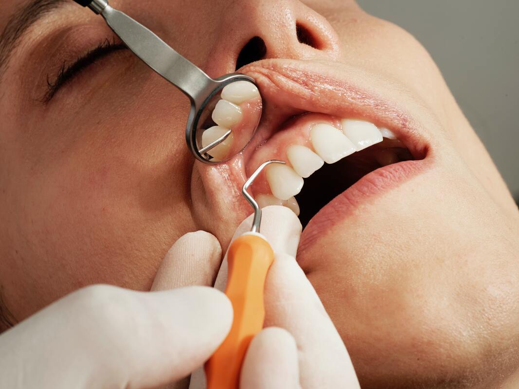 woman having a dental check up