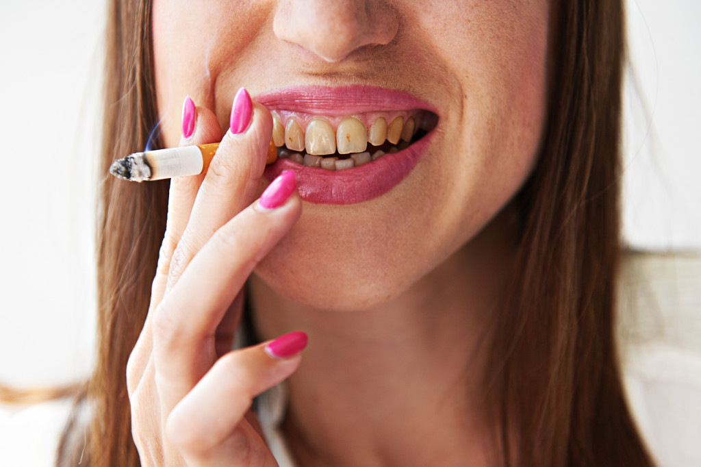 Smoking causing oral health issues